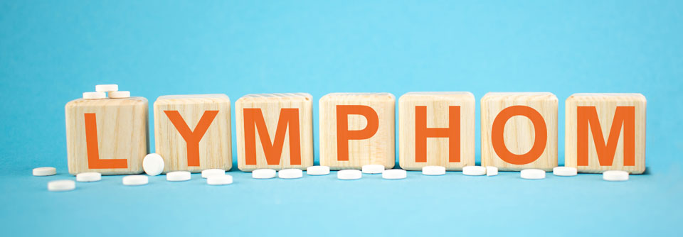 B-Zell-Neoplasien: Es kommt auf’s Lymphom an